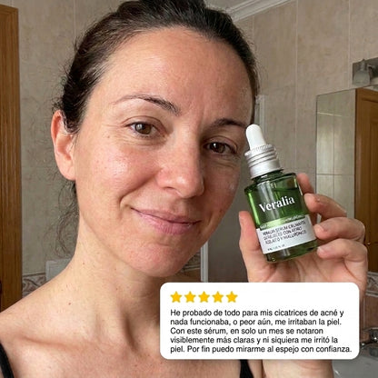 Veralia™ Sérum Azelaico para Manchas y Rojeces de Acné